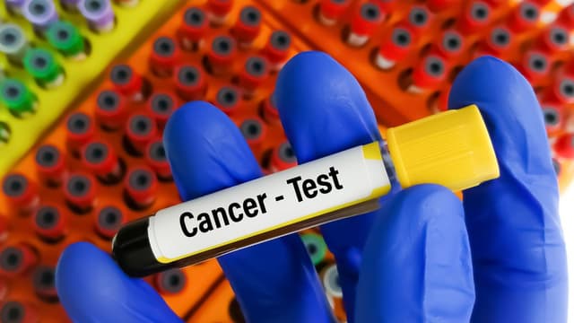 Early Cancer Screening Tests Every Adult Should Know 