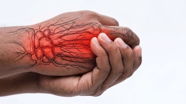 Numbness and Tingling: Is It a Nerve Problem?