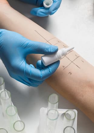 Allergy testing