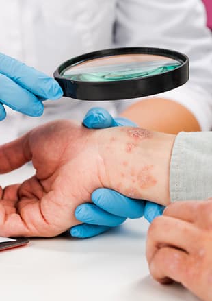 Allergy treatment programs