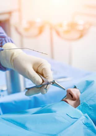 Nasal obstruction surgery