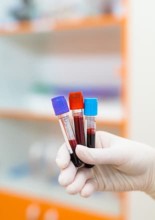 Blood biochemistry tests