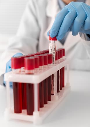 Hematology panels and complete blood counts