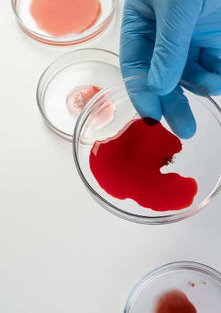 Histopathology and tissue examination