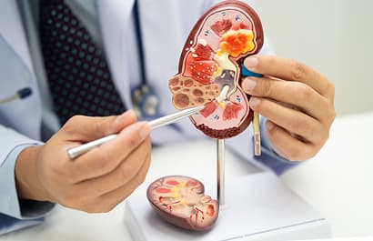 Specialized Kidney Care