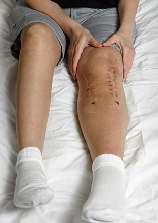 Post-surgical rehabilitation