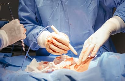 Microsurgery & Tissue Transfer